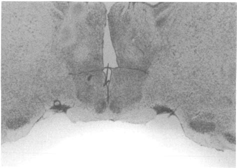 Figure 3 From The Angiotensin Ii Pressor System Of The Rat Forebrain