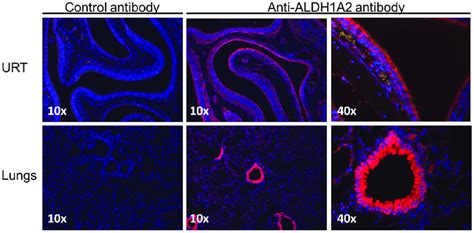 Respiratory Tract Epithelial Cells Produce Aldh1a2 Tissue Sections