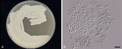 Malassezia Japonica Atlas Of Clinical Fungi