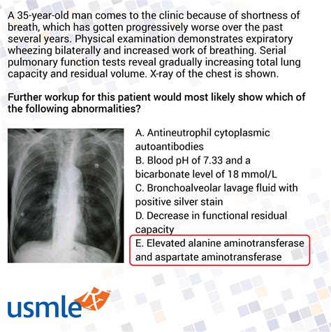 Using an e case view reveals details the public was never told 4