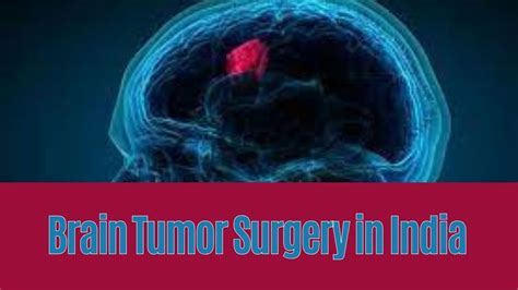 Brain Tumor Surgery And Treatment In India