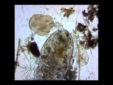 Protista In A Microscope