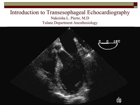 Introduction To Transesophageal Echocardiography