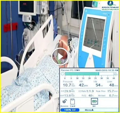 Best Way To Describe Trilogy Ventilator Manual 23 Ar Medical Technology