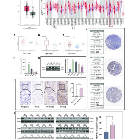 Nrep Levels In Gastric Cancer Gc Tissue A Expression Levels Of