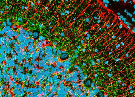 Immunofluorescently Labeled Neurofilament Protein And Glial Fibrillary