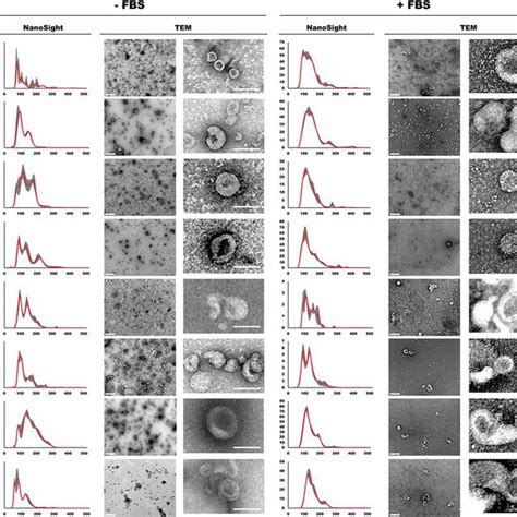 Characterization Of Extracellular Vesicles Isolated By Differential