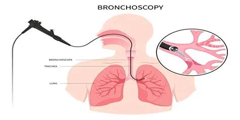 Flexible Bronchoscopy | Dubai Thoracic Surgery Clinic