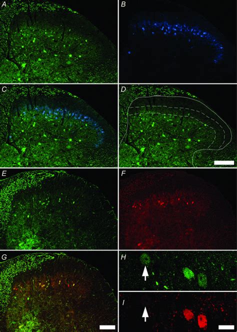 Morphological Neurochemical And Electrophysiological Features Of