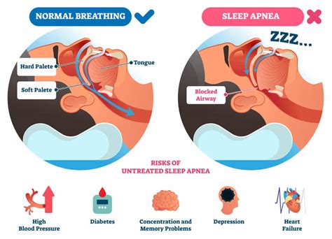 Pediatric And Adult Sleep Therapy Hme Specialists Cpap