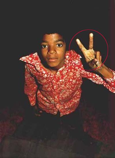 Michael Jackson Forever: Vitiligo... y aún así los haters dicen: No es ...