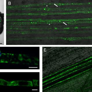 Analysis Of The Atseoa And Gmseo F Promoter In Transgenic Plant