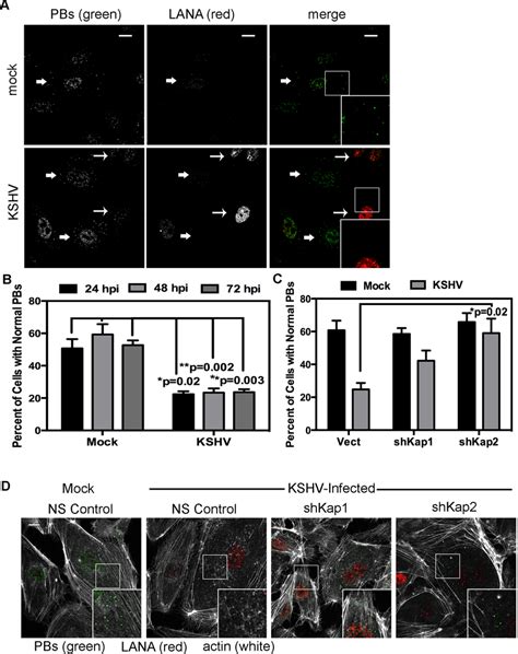 Kshv Mediated P Body Dispersion In Latently Infected Endothelial Cells