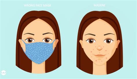 Anti Acne Face Masks How Do They Prevent Maskne Acne Help Mdacne