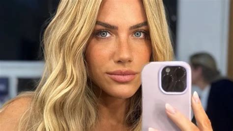 Giovanna Ewbank D Close No Rosto Ap S Cirurgia No Nariz E Arranca Elogios