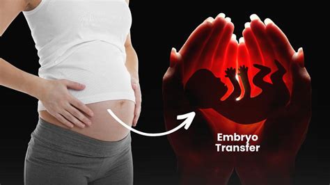 What Is Embryo Transfer and How Does It Work in IVF?