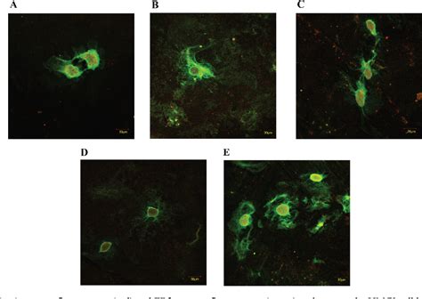 Figure 1 from The enhancement of Arg1 and activated ERβ expression in