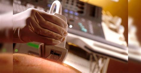 Female Foeticide Make Sex Determination Test Compulsory Says