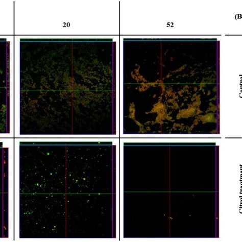 Confocal microscopy showing biofilm formation of isolated MRSA (18, 20 ...