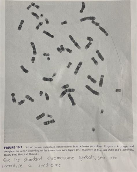 FIGURE 10.9 Set of human metaphase chromosomes from a | Chegg.com