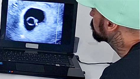 Ultrasound Videos XVIDEOS