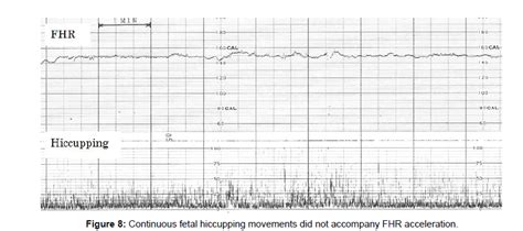 Fhr Acceleration