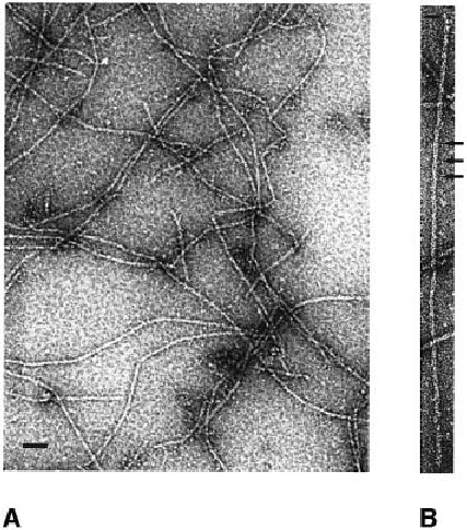 Analysis Of Electron Micrographs Of Parm A A Typical Parm Lament