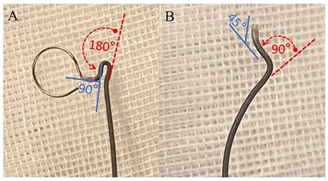 Frontiers Navigating Complexity A Comprehensive Review Of