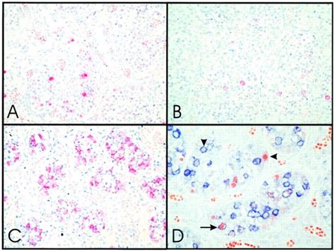 Representative Examples Of The Staining Patterns In A Testis Sample