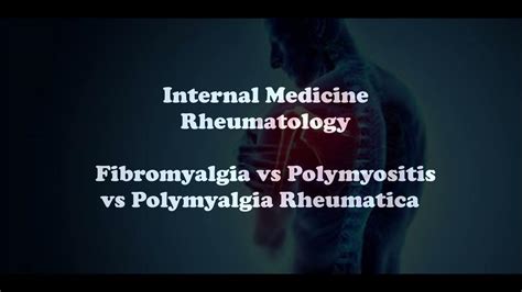 Im Rheum Fibromyalgia Polymyositis Polymyalgia Rheumatica Youtube