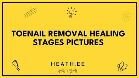 Toenail Removal Healing Stages Pictures: A Comprehensive Guide - Heathe