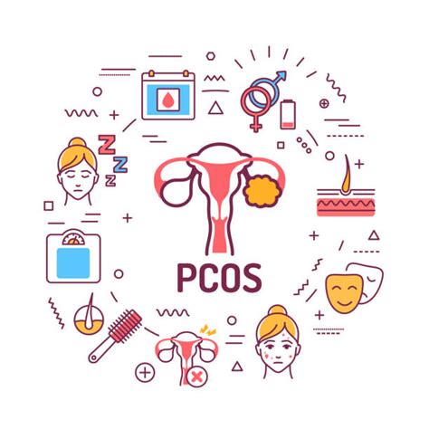 240 Polycystic Ovary Syndrome Stock Illustrations Royalty Free Vector