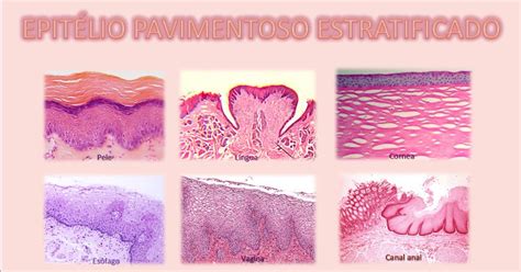 Tecido Epitelial De Revestimento Estratificado Pavimentoso