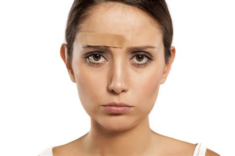 how to remove hair color from forehead