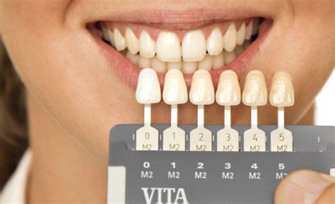 Determinaci N Del Color Con El Vita System D Master Dental Visionist