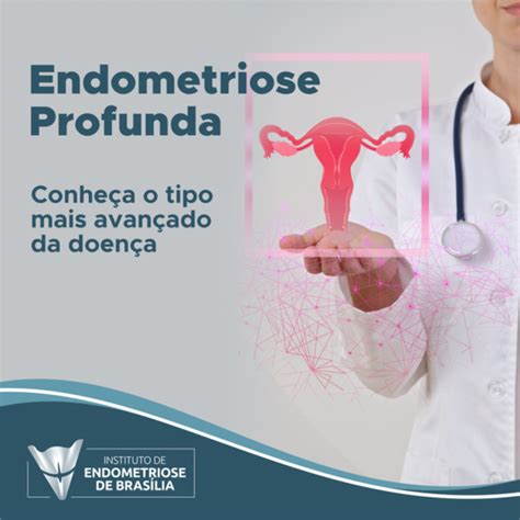 Endometriose Profunda Conhe A O Tipo Mais Avan Ado Da Doen A