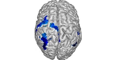 Hemisferio cerebral izquierdo partes características y funciones