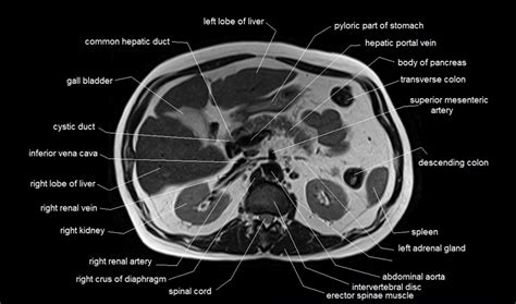 Mri Axial Abdomen Anatomy SexiezPicz Web Porn