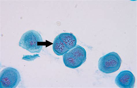 Meiosis