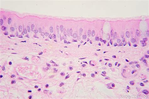 Pseudostratified Columnar Epithelium – Kit Ng, Ph.D.