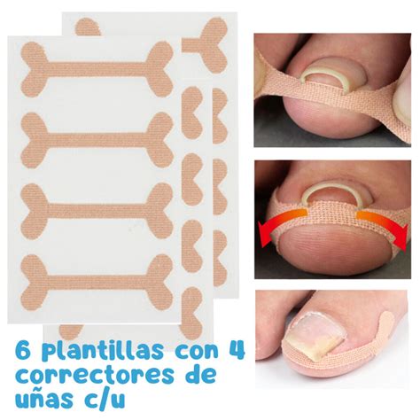 Kit Correcci N U As Encarnadas Pies Herramienta Pedicura Universo En