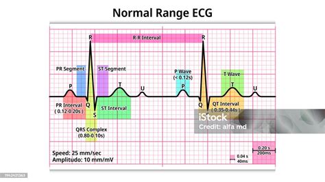 Normal Range Ecg Pr Interval Qrs Complex Qt Interval P And T Wave Stock ...