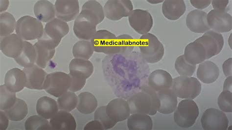 Leishman Stain Introduction Principle Uses Staining Requitrement