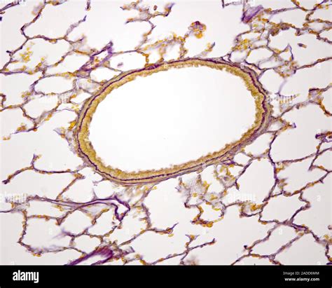 Bronchiole Light Micrograph Elastic Fibres In The Wall Of A Pulmonary