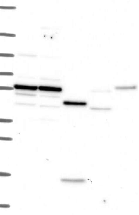 IL 10R alpha Antibody Novus Biologicals 25 μg Unconjugated Fisher