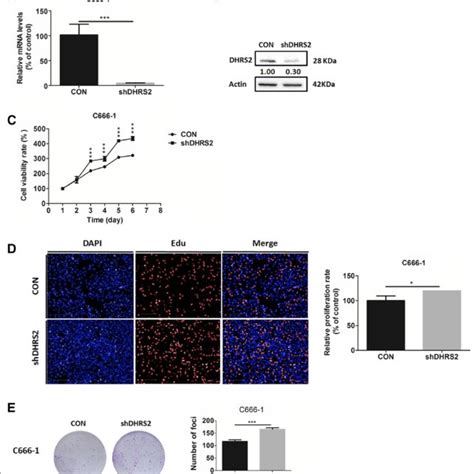 DHRS2 Overexpression Inhibits NPC Growth In Vivo A Growth Curve Of