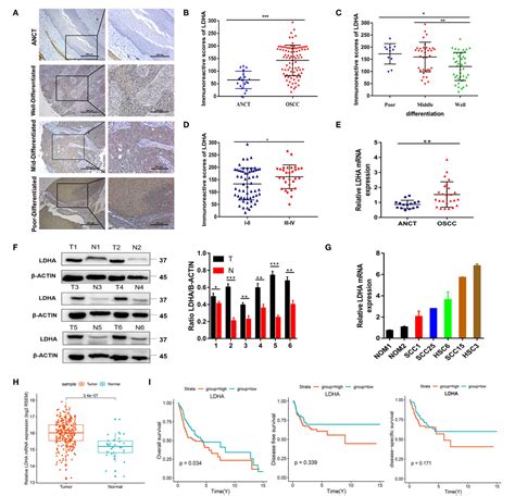 Figure 1 From Ldha Promotes Oral Squamous Cell Carcinoma Progression