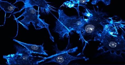 The Early Days of Cryonics Were a Complete Horror Show With Cracked ...