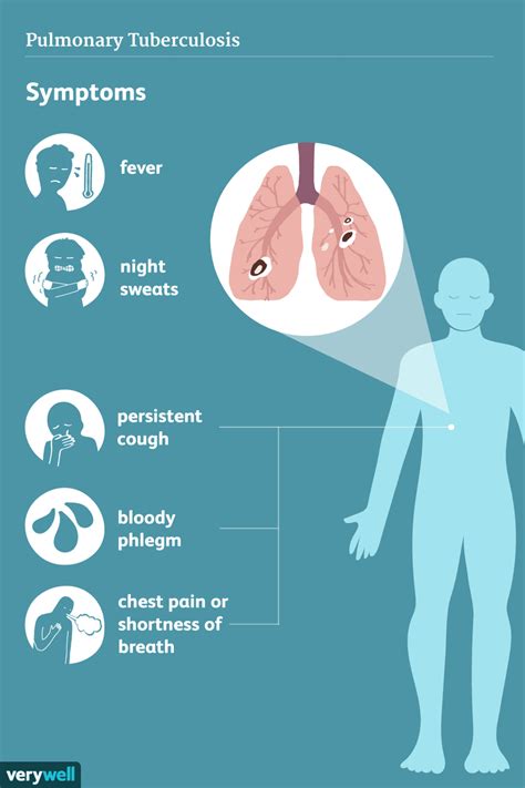 Tuberculosis: Signs, Symptoms, and Complications