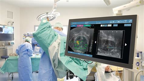 Prostate Fusion Biopsy Everything A Patient Should Know About Urology